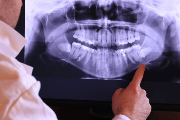 Best Broken Tooth Emergency  in Jamaica Beach, TX